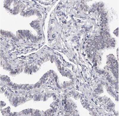 Immunohistochemistry-Paraffin: GNL2 Antibody [NBP1-81649]