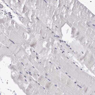 Immunohistochemistry-Paraffin: GNL2 Antibody [NBP1-81649]