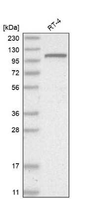 Western Blot: GNL2 Antibody [NBP1-81649]