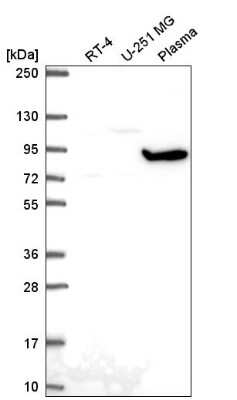 Western Blot: GNL2 Antibody [NBP2-57167]