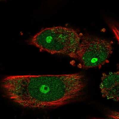 Immunocytochemistry/ Immunofluorescence: GNL3L Antibody [NBP2-32660]