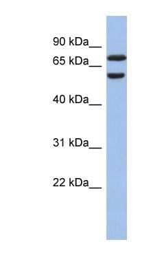 Western Blot: GNL3L Antibody [NBP1-55240]