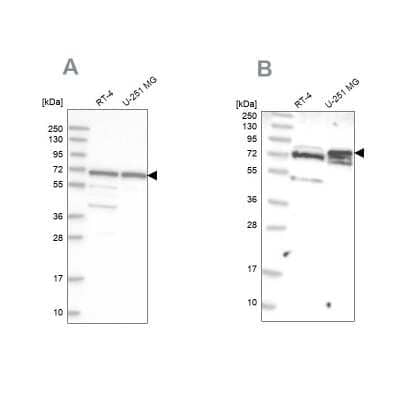 Western Blot: GNL3L Antibody [NBP1-84618]