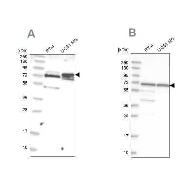 Western Blot: GNL3L Antibody [NBP2-32660]