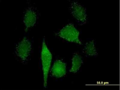 Immunocytochemistry/ Immunofluorescence: GNPAT Antibody [H00008443-B01P]