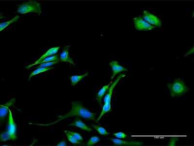 Immunocytochemistry/ Immunofluorescence: GNPAT Antibody [H00008443-D01P]