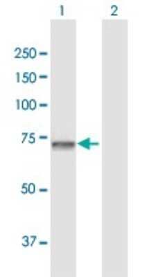 Western Blot: GNPAT Antibody [H00008443-D01P]