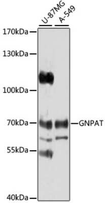 Western Blot: GNPAT AntibodyBSA Free [NBP3-05064]