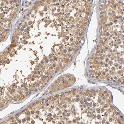 Immunohistochemistry-Paraffin: GNPDA1 Antibody [NBP1-83355]