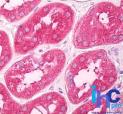 Immunohistochemistry-Paraffin: GNPDA1 Antibody [NBP2-24653]