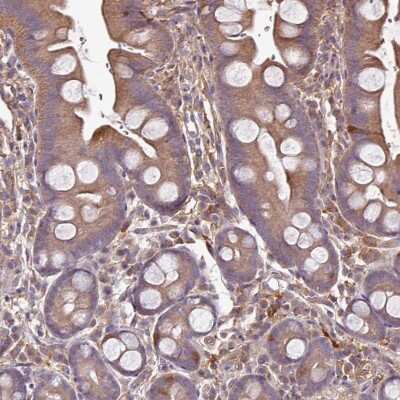 Immunohistochemistry-Paraffin: GNPDA1 Antibody [NBP2-33474]
