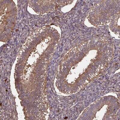 Immunohistochemistry-Paraffin: GNPDA1 Antibody [NBP2-33474]