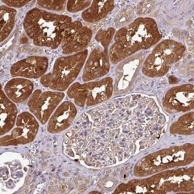 Immunohistochemistry-Paraffin: GNPDA1 Antibody [NBP2-33474]