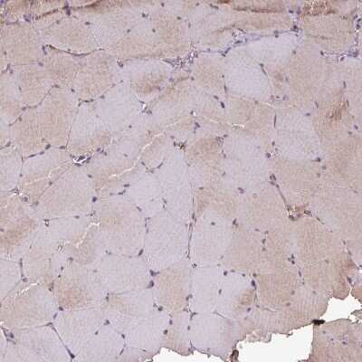 Immunohistochemistry-Paraffin: GNPDA1 Antibody [NBP2-33474]