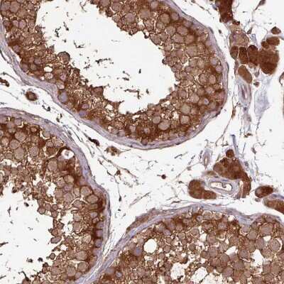 Immunohistochemistry-Paraffin: GNPDA1 Antibody [NBP2-33474]