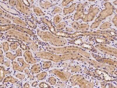 Immunohistochemistry-Paraffin: GNPDA1 Antibody [NBP2-97217]