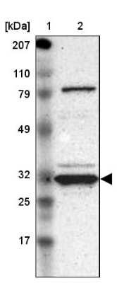 Western Blot: GNPDA1 Antibody [NBP1-83355]