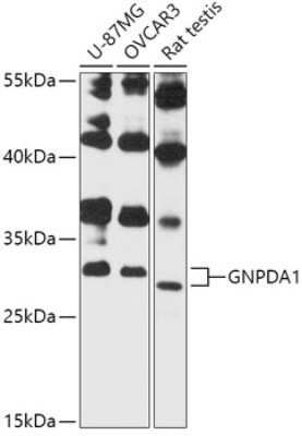 Western Blot: GNPDA1 AntibodyAzide and BSA Free [NBP3-04769]