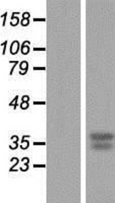 Western Blot: GNPDA1 Overexpression Lysate [NBP2-07745]