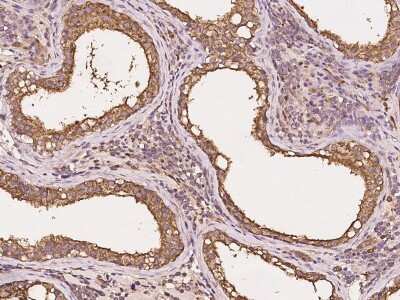 Immunohistochemistry-Paraffin: GNPDA2 Antibody [NBP2-99589]