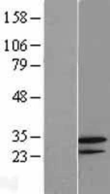 Western Blot: GNPDA2 Overexpression Lysate [NBL1-11189]