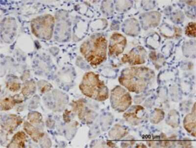 Immunohistochemistry-Paraffin: GNPNAT1 Antibody (1E9) [H00064841-M10]