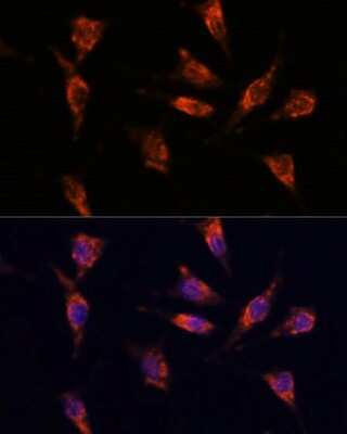 Immunocytochemistry/ Immunofluorescence: GNPNAT1 Antibody - Azide and BSA Free [NBP3-04814]