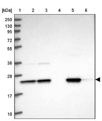 Western Blot: GNPNAT1 Antibody [NBP1-83842]