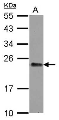 Western Blot: GNPNAT1 Antibody [NBP2-16702]