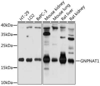 Western Blot: GNPNAT1 AntibodyAzide and BSA Free [NBP3-04814]