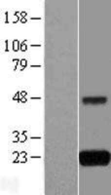 Western Blot: GNPNAT1 Overexpression Lysate [NBL1-11190]