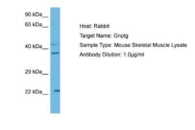 Western Blot: GNPTG Antibody [NBP2-87514]