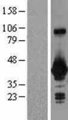 Western Blot: GNPTG Overexpression Lysate [NBL1-11191]