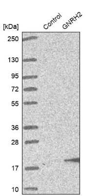 Western Blot: GNRH2 Antibody [NBP1-86515]