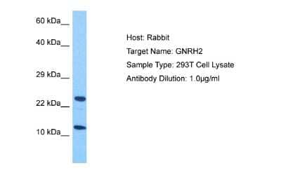 Western Blot: GNRH2 Antibody [NBP2-84995]