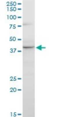 Western Blot: GNRHR2 Antibody (4A5) [H00114814-M01]