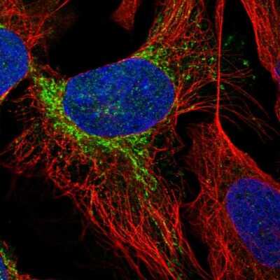 Immunocytochemistry/ Immunofluorescence: GNRPX Antibody [NBP2-13775]