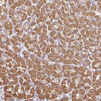 Immunohistochemistry-Paraffin: GNRPX Antibody [NBP2-13775]