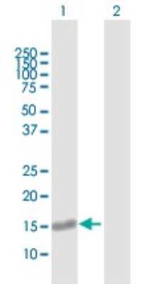 Western Blot: GNRPX Antibody [H00055111-B01P]