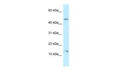 Western Blot: GNRPX Antibody [NBP2-87515]