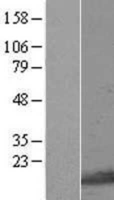 Western Blot: GNRPX Overexpression Lysate [NBL1-14511]