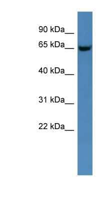 Western Blot: Glucosamine (N-acetyl)-6-Sulfatase/GNS Antibody [NBP1-68917]