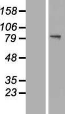 Western Blot: Glucosamine (N-acetyl)-6-Sulfatase/GNS Overexpression Lysate [NBL1-11193]