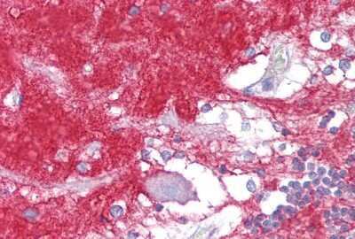 Immunohistochemistry: GO Protein alpha Antibody [NBP3-09336]