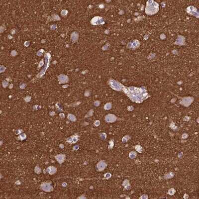 Immunohistochemistry-Paraffin: GO Protein alpha Antibody [NBP2-38477]