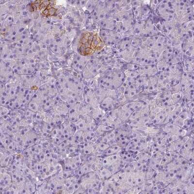 Immunohistochemistry-Paraffin: GO Protein alpha Antibody [NBP2-38477]