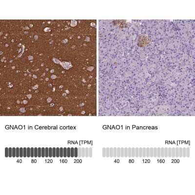 Immunohistochemistry-Paraffin: GO Protein alpha Antibody [NBP2-38477]