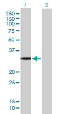 Western Blot: GO Protein alpha Antibody [H00002775-B01P]