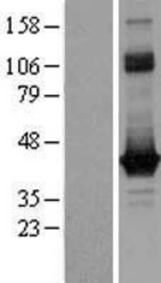 Western Blot: GO Protein alpha Overexpression Lysate [NBP2-05629]