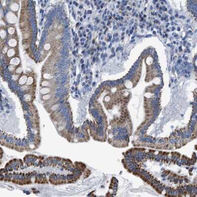 Immunohistochemistry-Paraffin: GODZ Antibody [NBP1-91951]